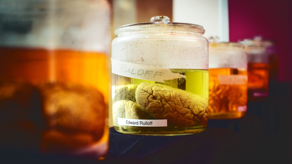 Rulloff's brain in a jar.