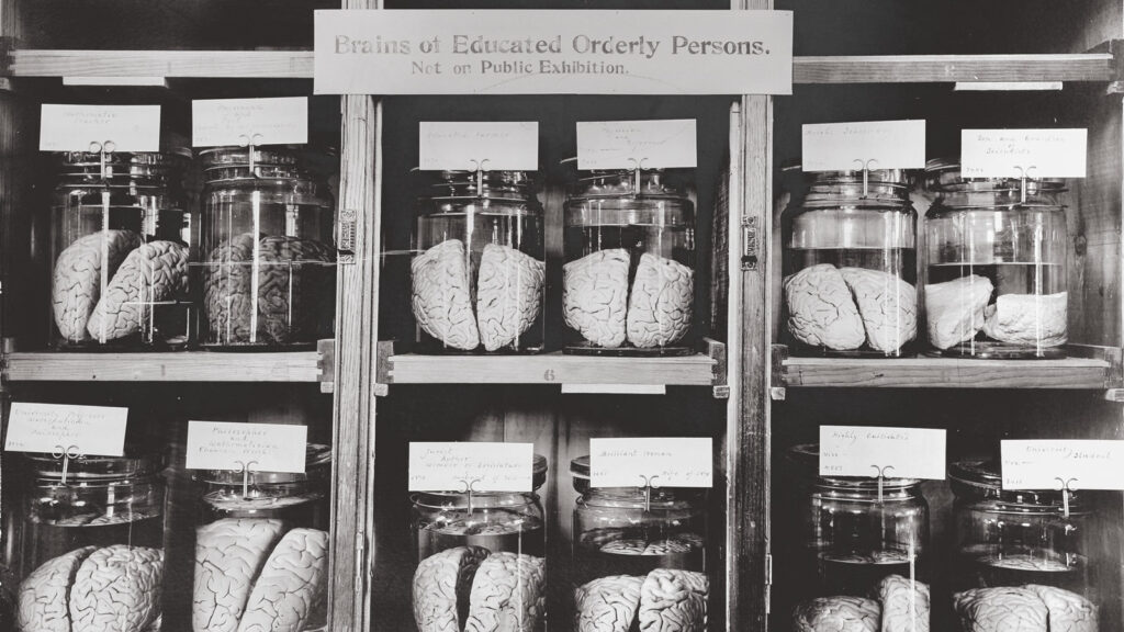 Brains on display: A detail view of part of the collection in the late 1800s