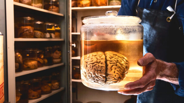 Brains! Collection Is a (Slightly Spooky) Artifact of an Earlier Era