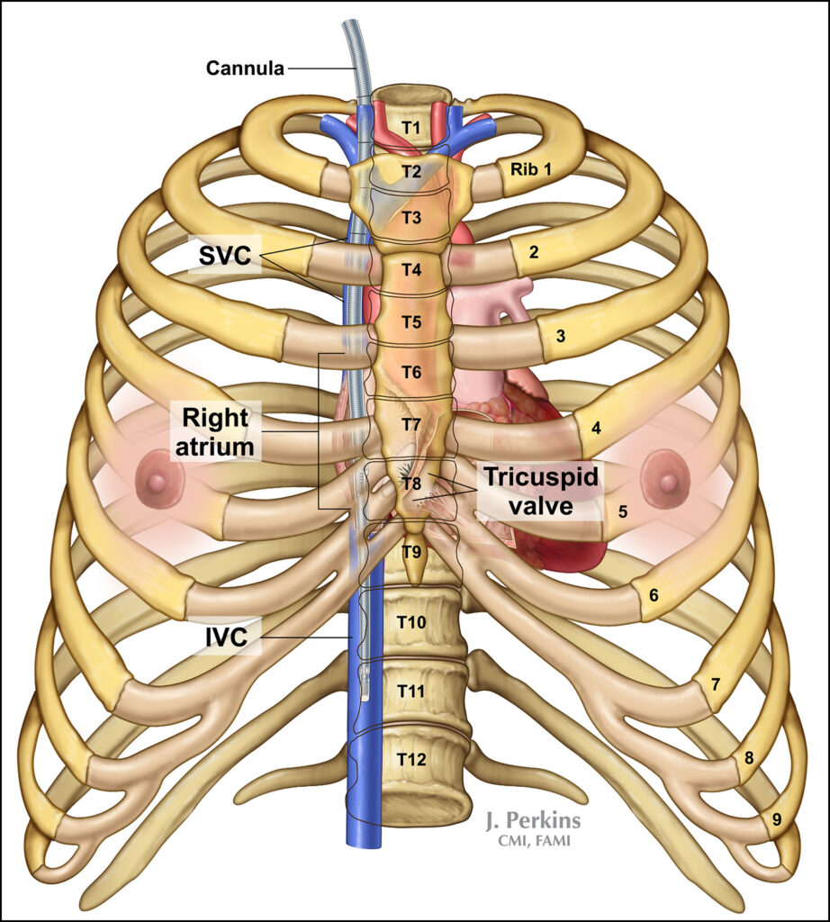 A medical illustration depicting the heart and ribs.