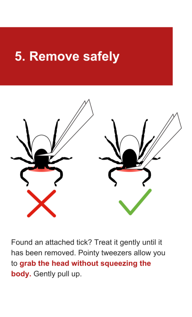 An illustration showing how to correctly and incorrectly remove a tick with tweezers. The text says: 5. Remove safely. Found an attached tick? Treat it gently until it has been removed. Pointy tweezers allow you to grab the head without squeezing the body. Gently pull up.