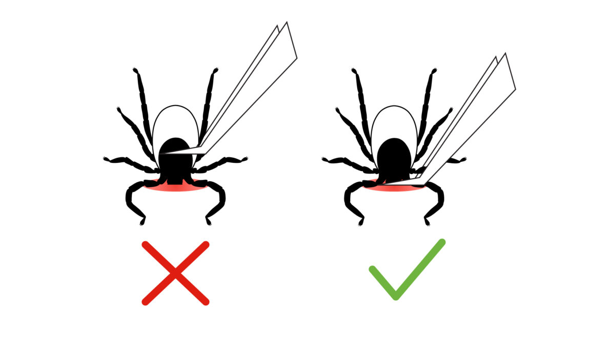 Staying Safe During Tick Season: An Illustrated Guide for People and Pets