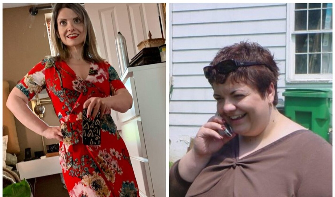 Photos of Jean prior to (right) and after successful treatment (left) using the Evolve software platform. As of August 2021, Jean had lost over half of her initial weight, says her doctor, Katherine H. Saunders MD '11.